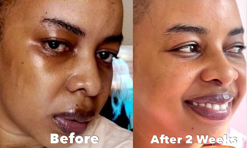 Baobab Glow-c Serum before-and-after